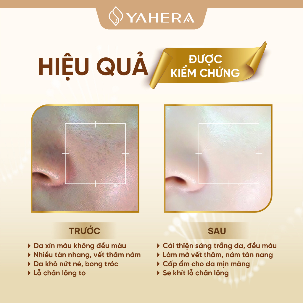 Bộ đôi dưỡng trắng ban đêm YAHERA Gồm serum dưỡng trắng 30g và kem dưỡng trắng da mặt 20g