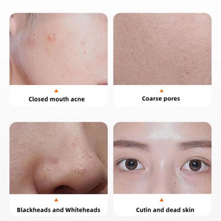 MẶT NẠ SỦI  BỌT THẢI ĐỘC CÀ RỐT ( hộp 12 gói )