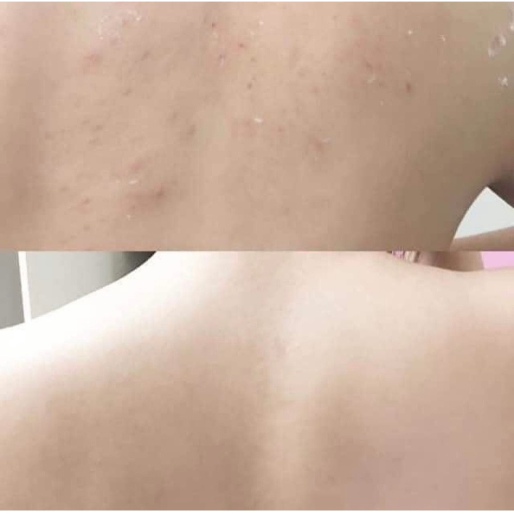 Sữa Tắm St.Ives Tẩy Tế Bào Chết Dịu Nhẹ Dưỡng Da - St. Ives Soothing Body Wash 650ml