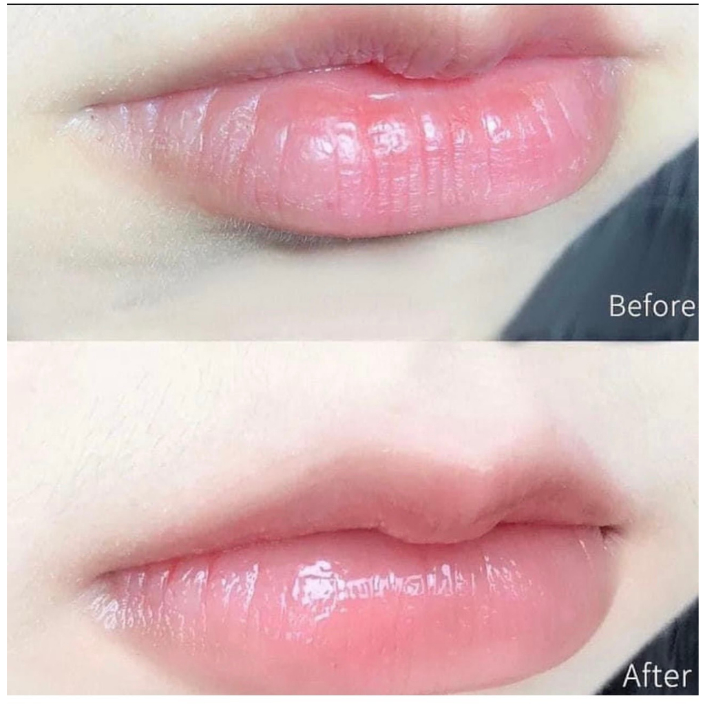 USA Sáp Son Dưỡng Môi Vaseline Mang Lại Làn Môi Mềm Mọng Ngay Lần Đầu Sử Dụng 7g