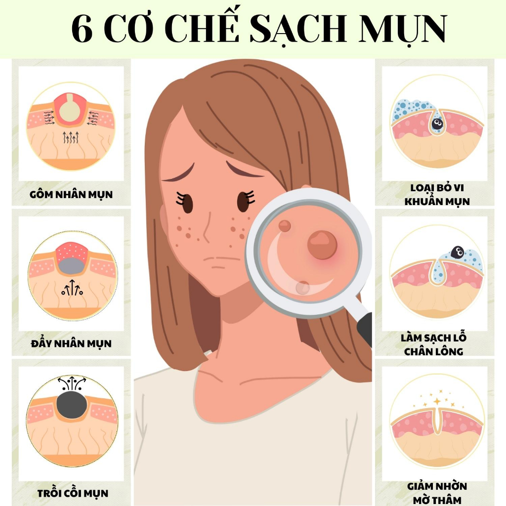 Kem Giảm Mụn Ẩn ,Mụn Đầu Đen ,Mụn Thâm Doctor Care Acnes Elimination cream Cho Da Dầu 30g