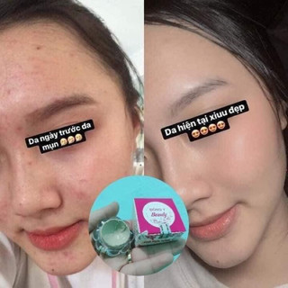 (chính hãng ) kem mụn dưỡng da hoa đào