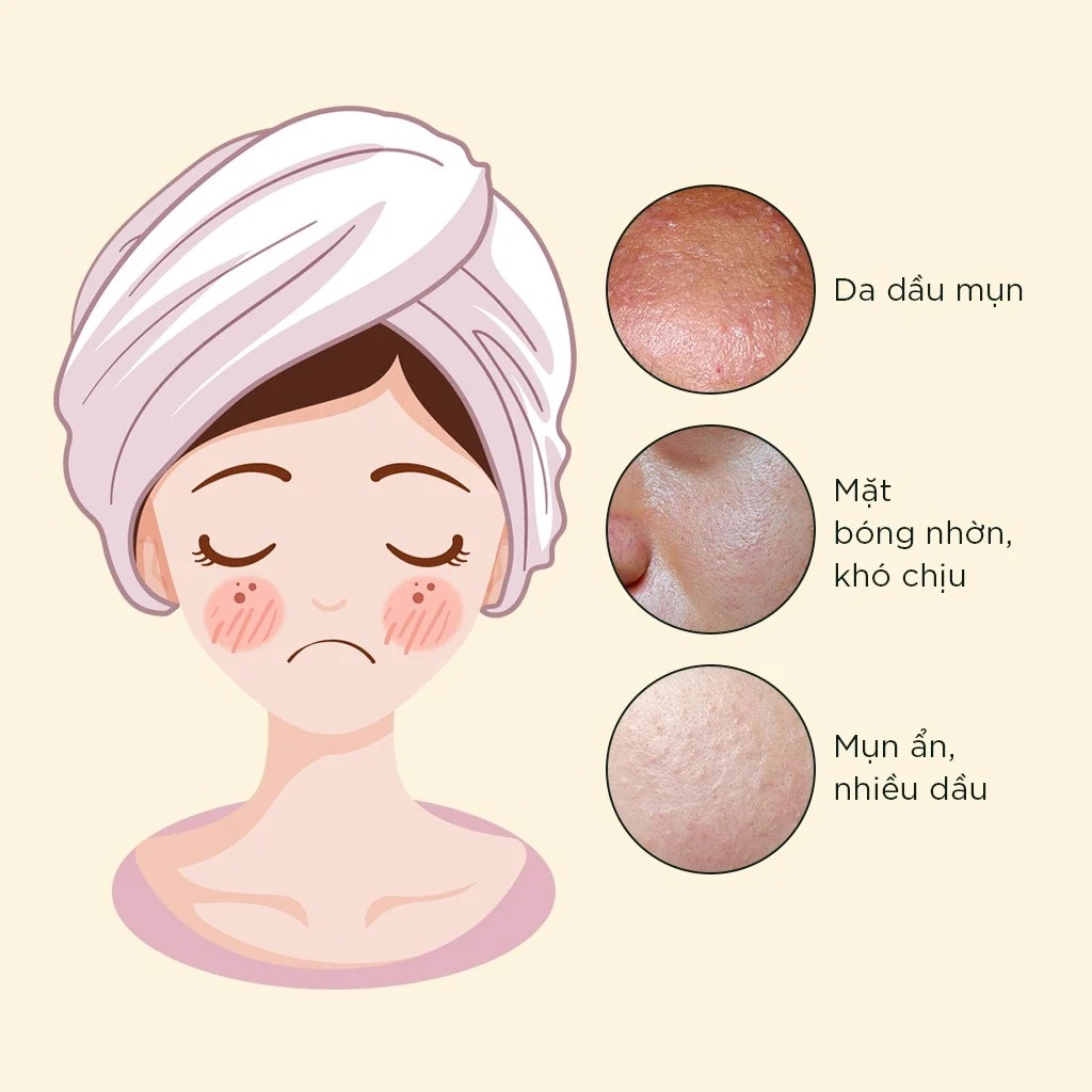 [Mua 1 Tặng 1] Kem Dưỡng Ẩm Cân Bằng Dầu Sukin Oil Balancing Mattifying Facial Moisturiser 125ml (HSD: 15/07/2024)