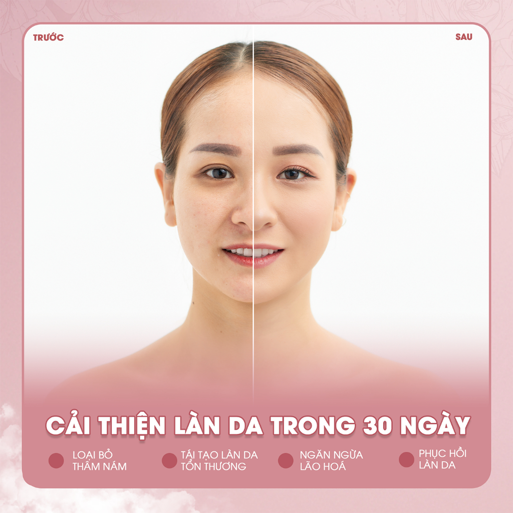 COMBO Kem Dưỡng Trắng Da Và Viên Sủi 22 AGAIN Giúp Tái Tạo Collagen, Ngăn Ngừa Lão Hoá, Mờ Nám, Phục Hồi Da - Hộp 30g