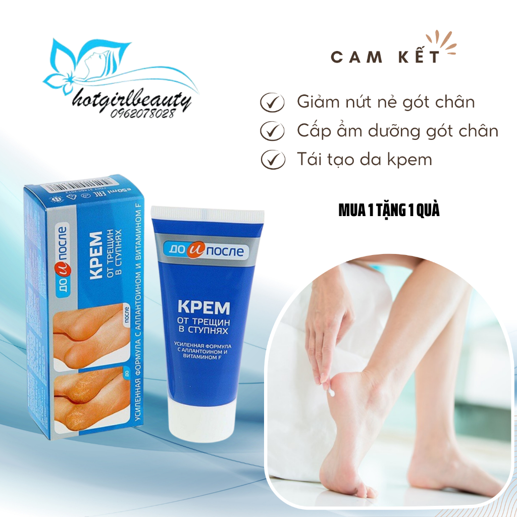 Kem nẻ gót chân Kpem Foot Cream giảm nẻ chân, nứt chân, khô da chân, dưỡng gót chân