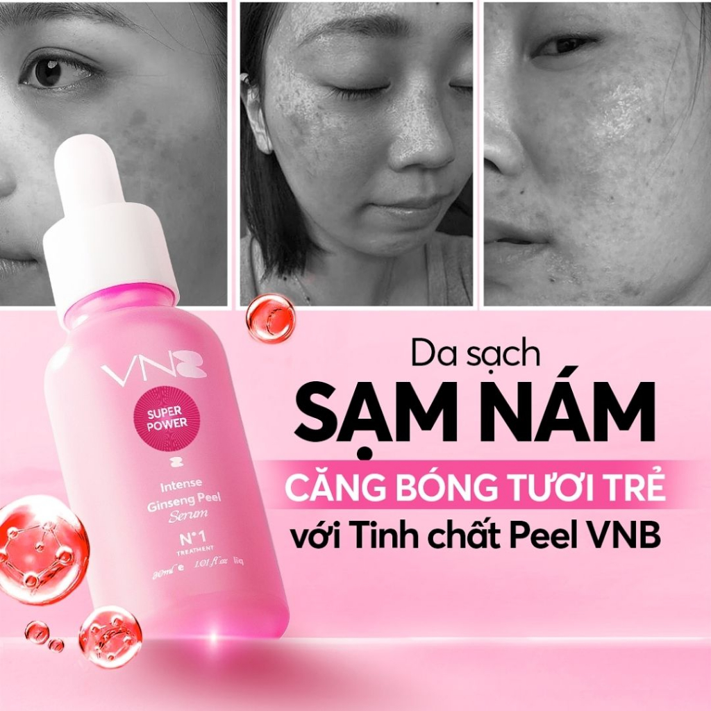 Peel Mạnh VNB - Tinh Chất Peel Da VNB Bí Quyết Xóa Nám Tàn Nhang Da Không Đều Màu