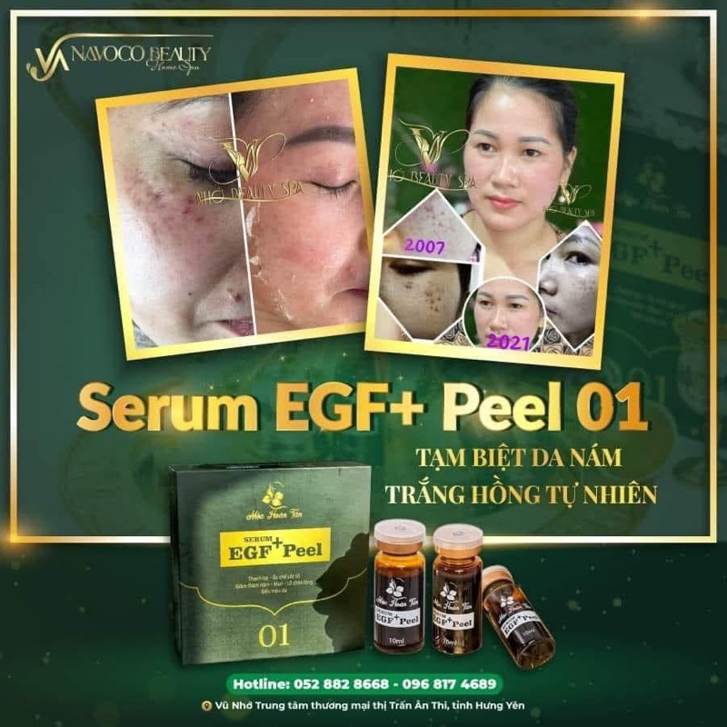 Peel 1 navo hộp 2 lọ