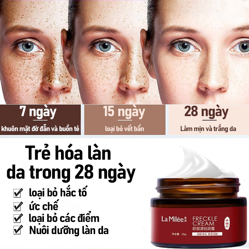 Kem xóa tàn nhang kem xóa nám làm trắng da tinh chất chất làm trắng da mặt và loại bỏ nám làm sáng da chăm sóc 30g