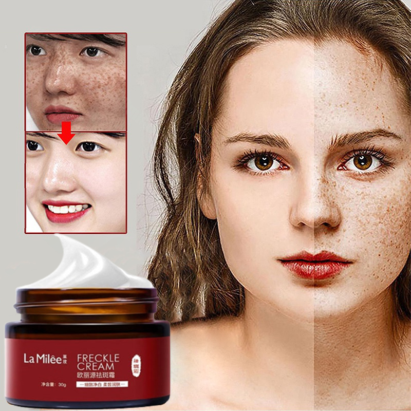 Kem xóa tàn nhang kem xóa nám làm trắng da tinh chất chất làm trắng da mặt và loại bỏ nám làm sáng da chăm sóc 30g