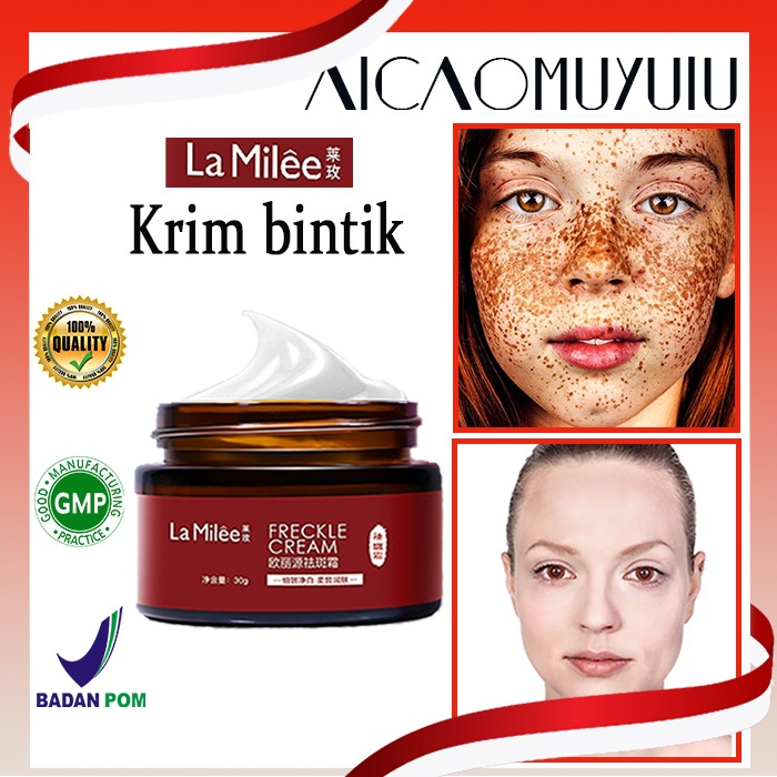 Kem xóa tàn nhang kem xóa nám làm trắng da tinh chất chất làm trắng da mặt và loại bỏ nám làm sáng da chăm sóc 30g