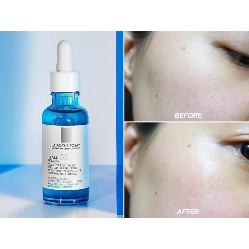 Serum Cấp Ẩm Phục Hồi Da La R.o.c.h.e - P.o.s.a.y H.y.a.l.u B5