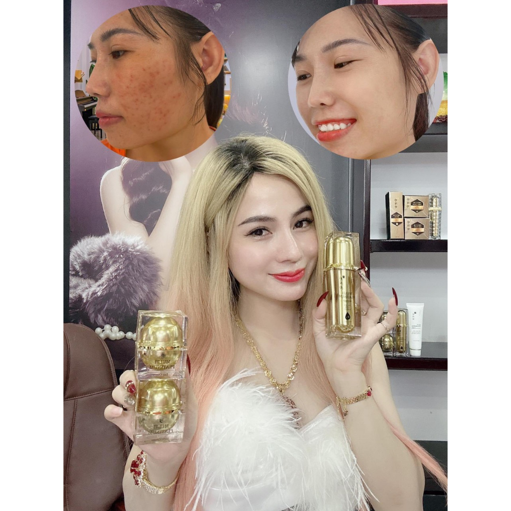 Shop Hiền _ Bộ kem Multi Platinum