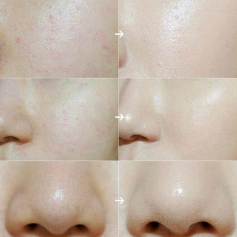 Phấn phủ kiềm dầu - làm mịn da Prettyskin 5g