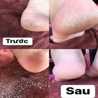 Hộp Nhám dán máy Chà Gót Chân (60 miếng)🥰