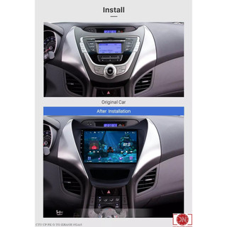 mặt dưỡng HYUNDAI ELANTRA 2013-2015