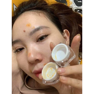 Bộ Kem và serum nghệ Thái