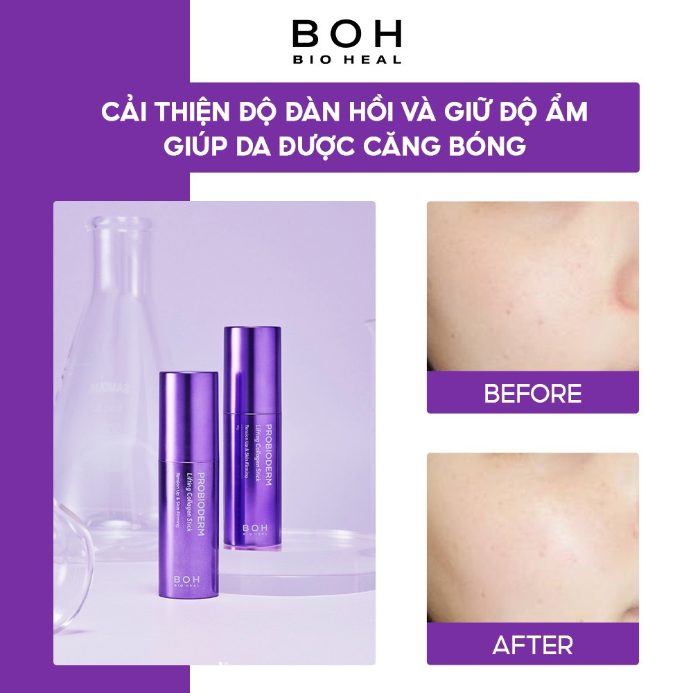 Thanh Lăn Nâng Cơ BIOHEAL BOH PROBIODERM LIFTING COLLAGEN STICK 10G