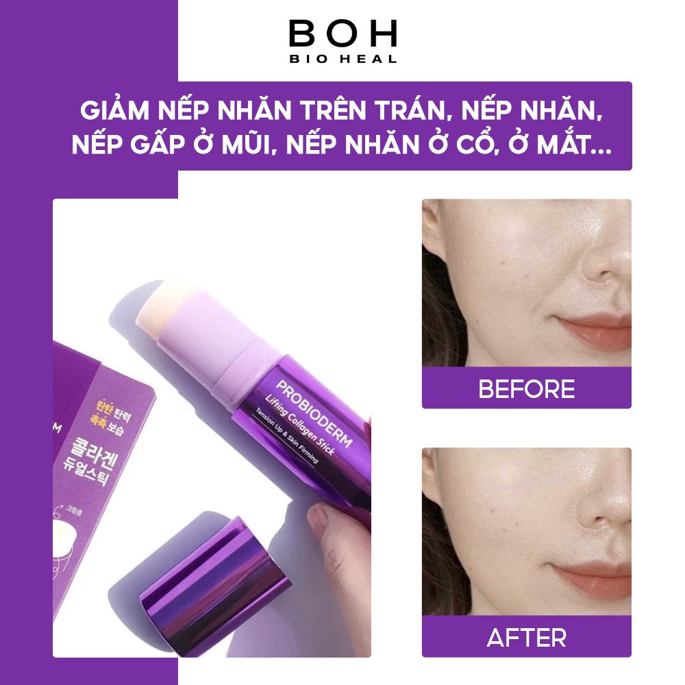 Thanh Lăn Nâng Cơ BIOHEAL BOH PROBIODERM LIFTING COLLAGEN STICK 10G