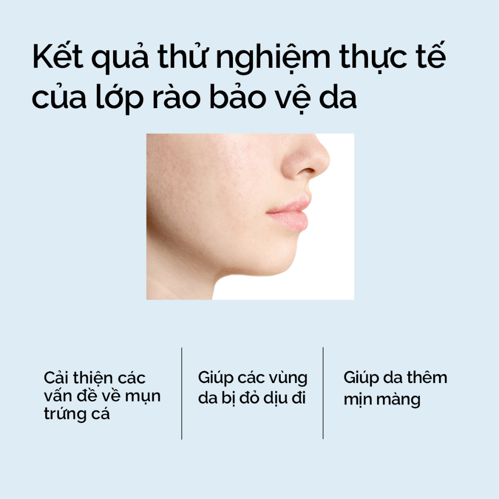 Gel dưỡng ẩm cho da khoẻ mạnh 5X Ceramide Gel dưỡng ẩm SKINTIFIC 30g