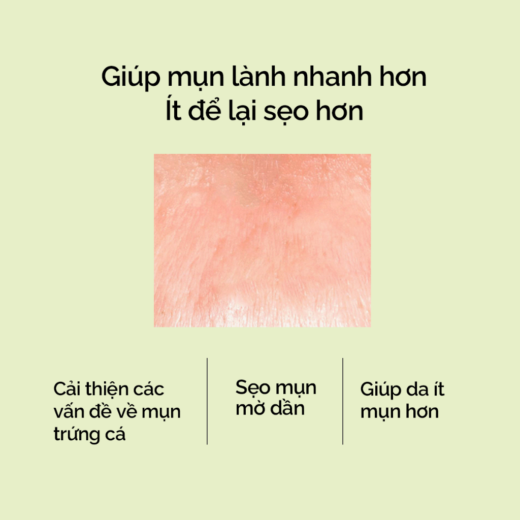 Gel chấm lên mụn 2% BHA SKINTIFIC 10g