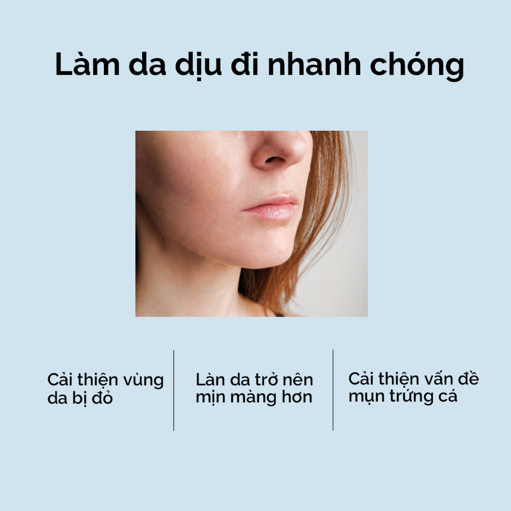 Toner làm da dịu đi 5X Ceramide SKINTIFIC 80ml