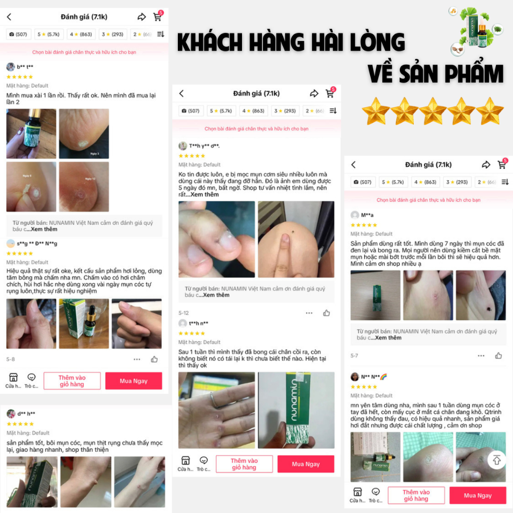 Tinh Chất Chấm Mụn Cóc, Mụn Thịt, Mắt Cá Chân Lâu Năm Nunamin 15 ML + Tặng Băng Gâu X2