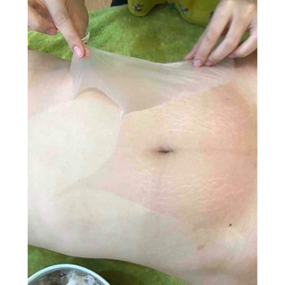 Lột trắng thay da (tay chân) NN Collagen