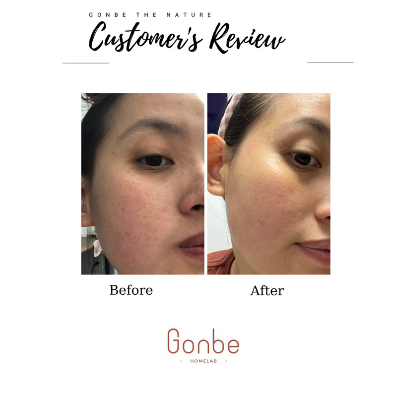 HỦ KEM DƯỠNG DA - FACIAL CARE