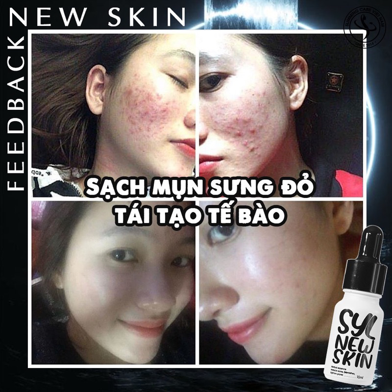 KÉN TẰM PHỤC HỒI DA NEWSKIN 10ml