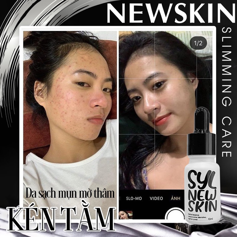KÉN TẰM PHỤC HỒI DA NEWSKIN 10ml