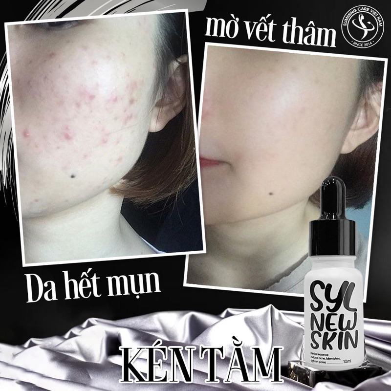 KÉN TẰM PHỤC HỒI DA NEWSKIN 10ml