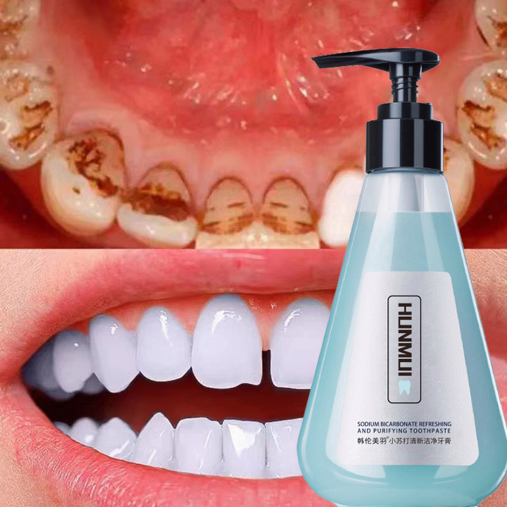 【Mua 1 tặng 2】Kem Đánh Răng HUNMUI 210ML Chống sâu răng Kem Đánh Răng Dạng Gel Lỏng Thơm-Vệ Sinh Răng Miệng Không Hôi Mi