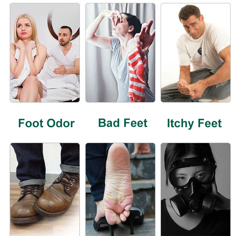 Kem Khử Mùi Hôi Mùi chân LAMISIL Khuẩn Ngăn Mồ Hôi Và Làm Sạch Mùi 15g Giảm ngứa Loại bỏ mùi hôi thối