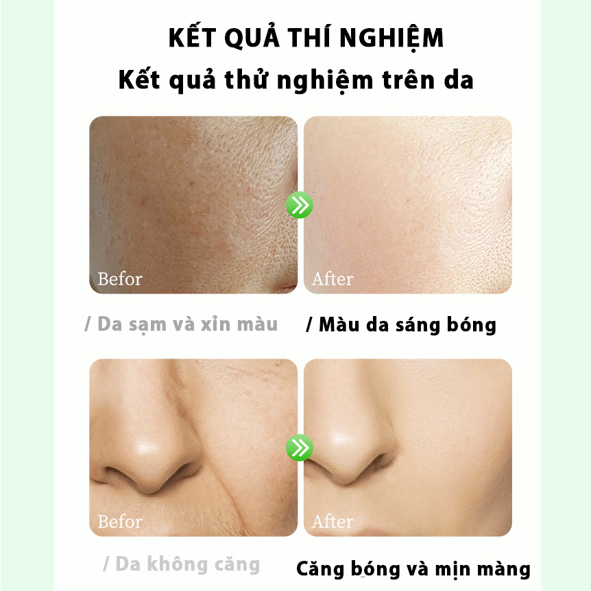 Mặt nạ giấy dưỡng da vitamin E C A B tăng collagen giảm thâm nám kiểm soát