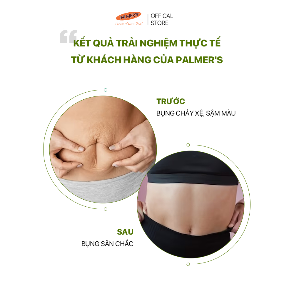 Sữa dưỡng thể làm săn chắc da sau sinh Palmer's 315ml