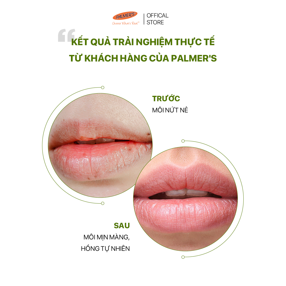 Son dưỡng môi ngăn ngừa khô, nứt nẻ Palmer’s - SPF15 4g