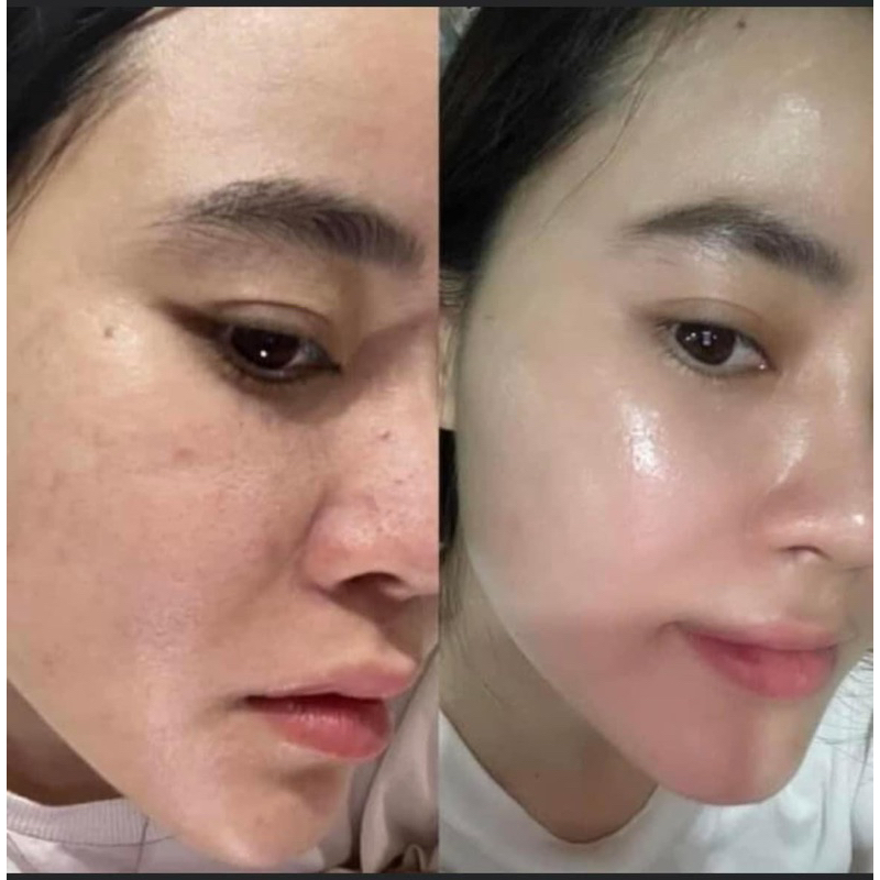 Tẩy da chết hoá học fullsize