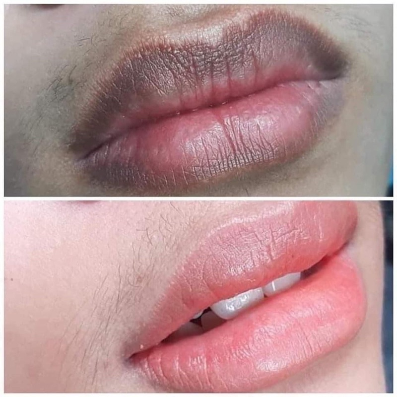 Son Dưỡng Môi Nano Collagen  Giảm Thâm, Kích Màu Môi Sau Phun Xăm, Dưỡng Môi Mềm Mịn Căng Bóng Lên Màu Đẹp