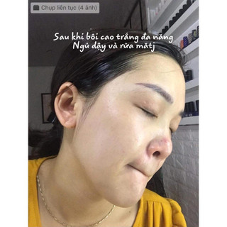 Cao Trắng Da Bách Y Sâm