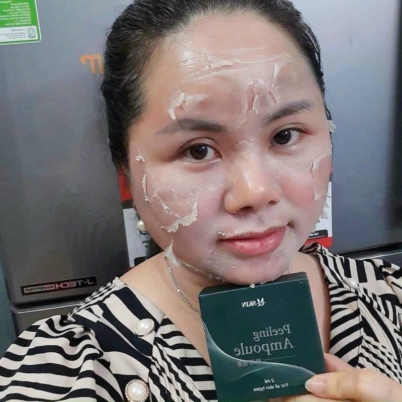 Peel Da Sinh Học Đa Tầng MQ Skin Chính Hãng Tái Tạo Da MQSKin