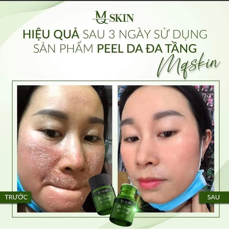 Peel Da Sinh Học Đa Tầng MQ Skin Chính Hãng Tái Tạo Da MQSKin