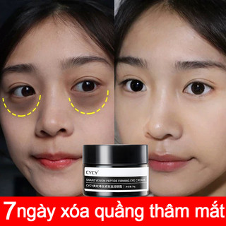  kem dưỡng mắt trị thâm mắt kem trị thâm quầng mắt 30g quầng thâm mắt xóa quầng thâm mắt giảm nếp nhăn 
