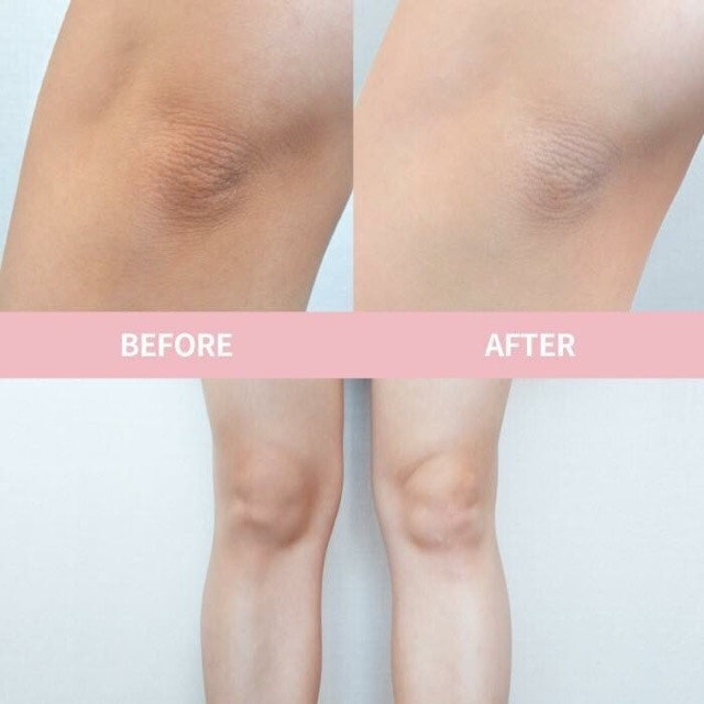 Kem Giảm Thâm Nách Vacosi Whitening Armpit Cream, Kem Dưỡng Trắng Nách, Vùng Bikini 30ml VMP02 Hàn Quốc