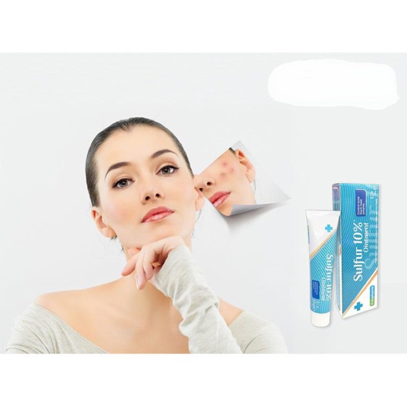 KEM MỤN SULFUR OINTMENT 10%  30g
