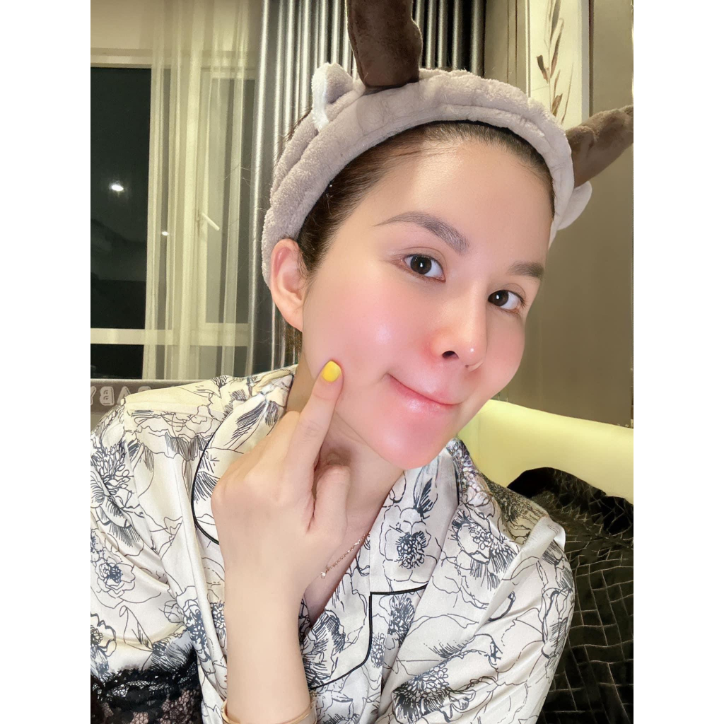 Kem nám Melasma Treament Cream Viian - Siêu phẩm thổi bay chân nám, làm trắng da