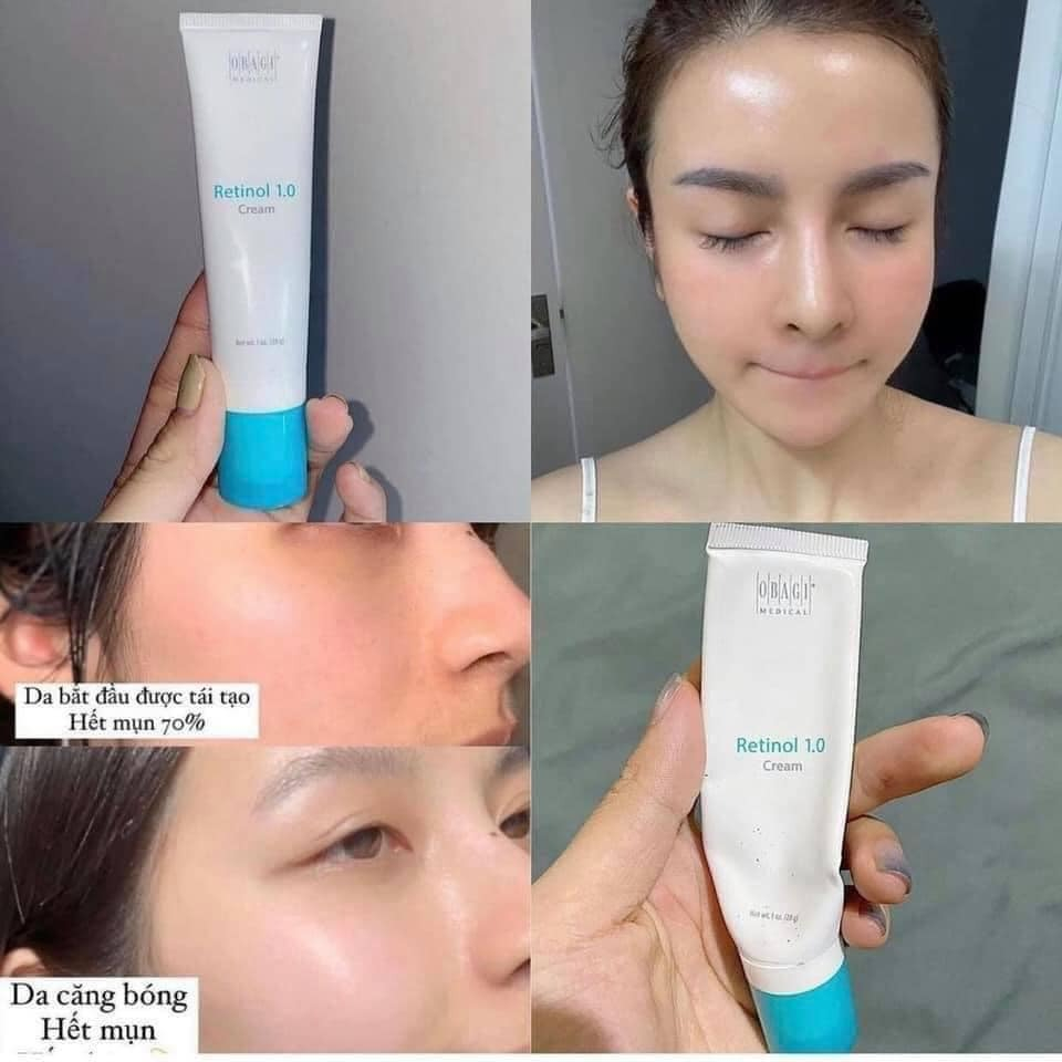 Kem dưỡng Obagi Retinol 1.0 Cream 28g chống lão hóa, trẻ hóa da