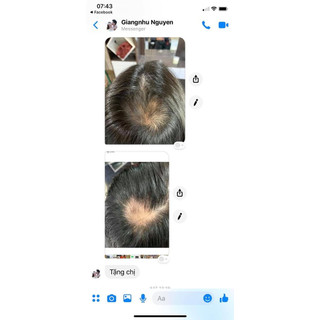 Mọc Tóc Do Thái - Multi Hair date 03/2025