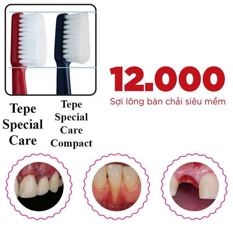 Bàn chải đánh răng siêu mềm - dùng sau phẫu thuật răng miệng Tepe Special Care