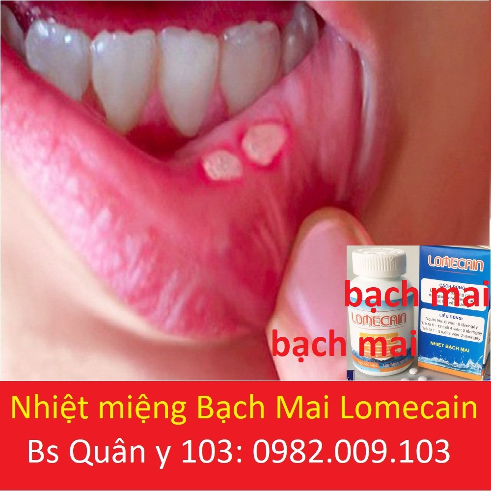Lọ 500 viên Lomecain nhiệt miệng bạch mai