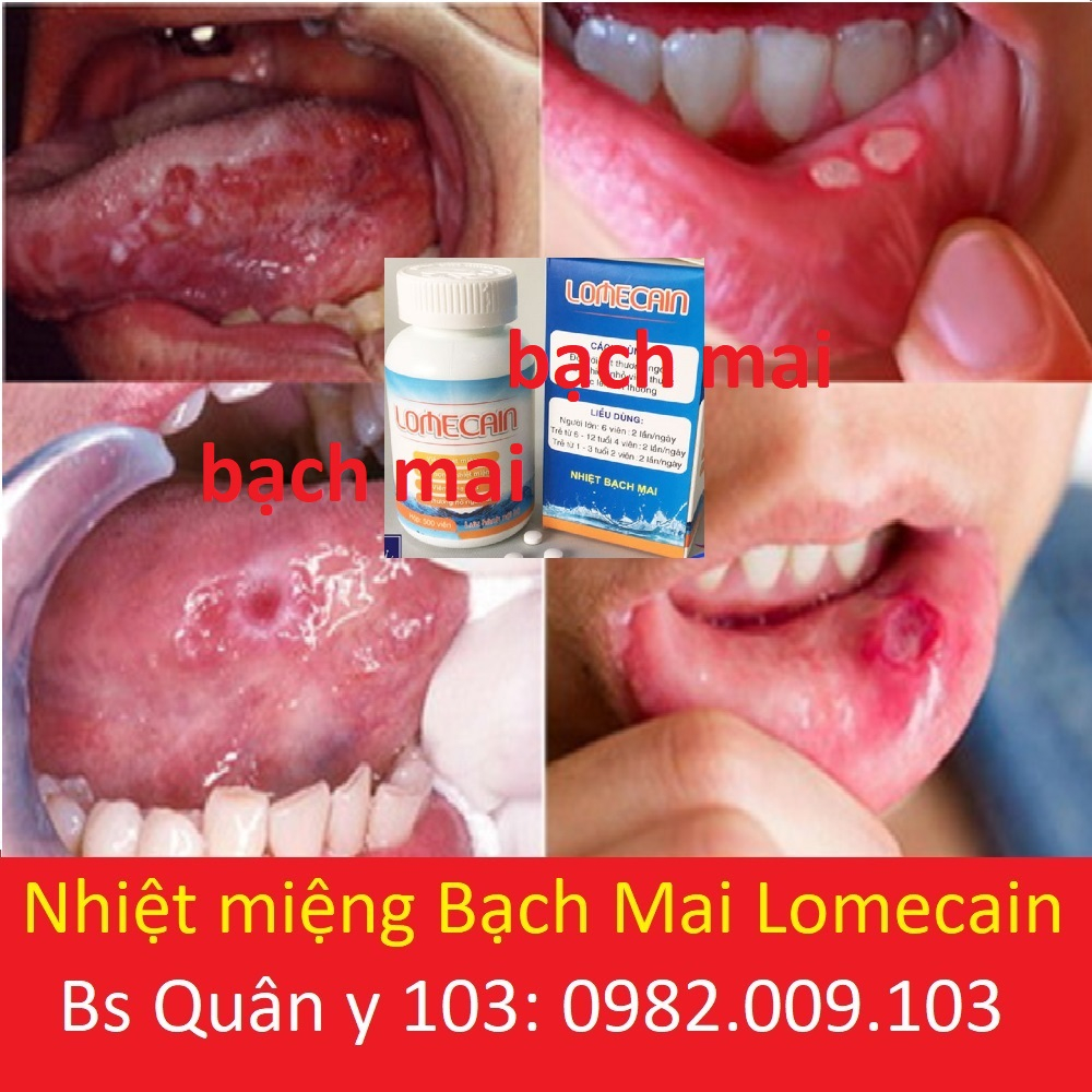 Lọ 500 viên Lomecain nhiệt miệng bạch mai